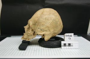 Forensic Anthropology 2